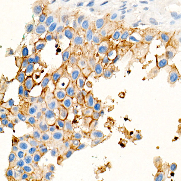CEACAM5 Mouse Monoclonal Antibody - Image 7