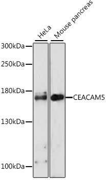 CEACAM5 Rabbit Polyclonal Antibody