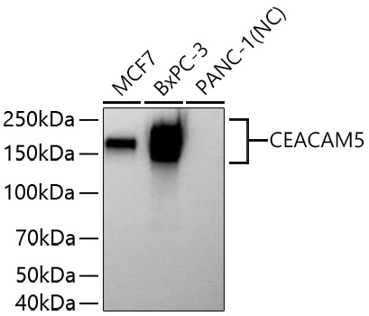 CEACAM5 Rabbit Polyclonal Antibody