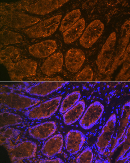 CEACAM6 Rabbit Monoclonal Antibody - Image 2