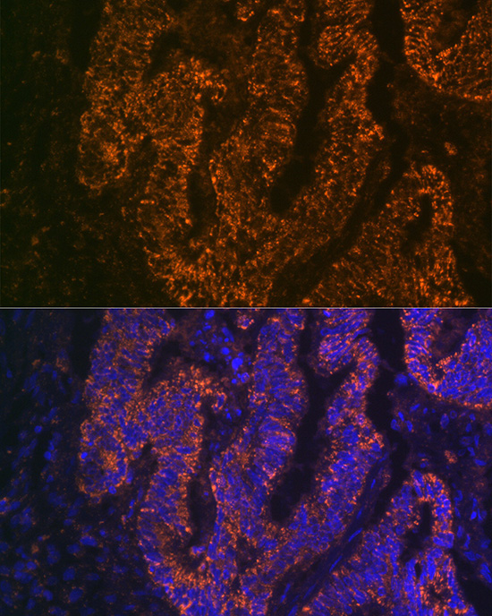 CEACAM6 Rabbit Monoclonal Antibody - Image 3