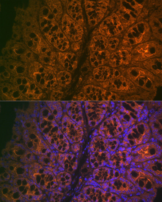 CEACAM6 Rabbit Monoclonal Antibody - Image 4