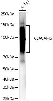 CEACAM6 Rabbit Polyclonal Antibody