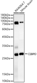 CEBP Delta/CEBPD Rabbit Polyclonal Antibody
