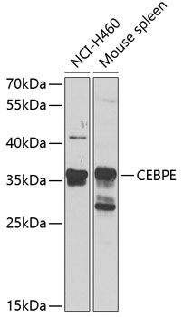 CEBPE Rabbit Polyclonal Antibody
