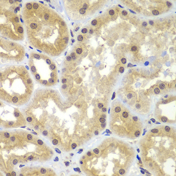 CEBPG Rabbit Polyclonal Antibody - Image 3