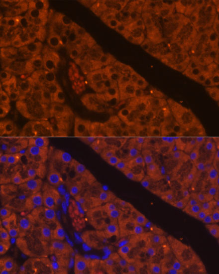 CELA2A Rabbit Polyclonal Antibody - Image 2