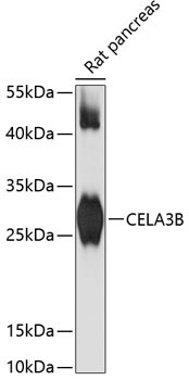 CELA3B Rabbit Polyclonal Antibody