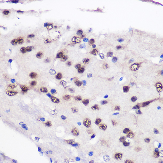 CELF1 Rabbit Polyclonal Antibody - Image 2