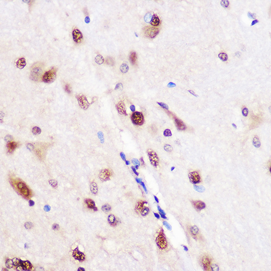 CELF1 Rabbit Polyclonal Antibody - Image 3