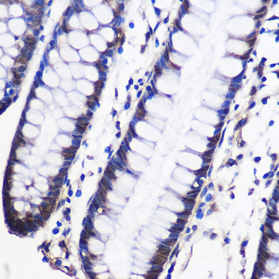 CELF1 Rabbit Polyclonal Antibody - Image 4