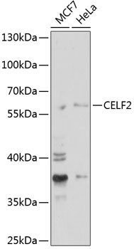 CELF2 Rabbit Polyclonal Antibody