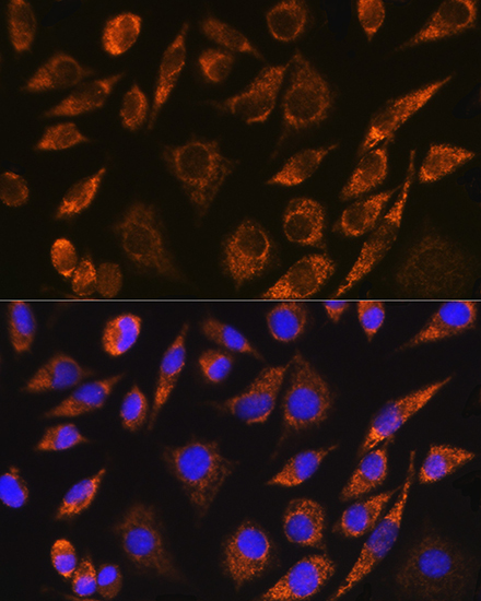 CELF5 Rabbit Polyclonal Antibody - Image 2