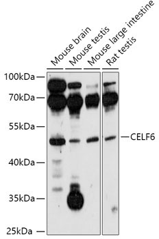 CELF6 Rabbit Polyclonal Antibody