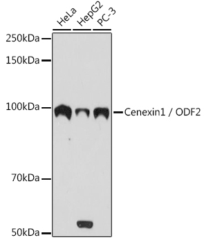 Cenexin1 / ODF2 Rabbit Monoclonal Antibody