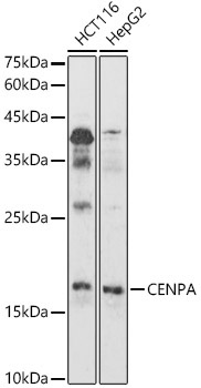 CENPA Rabbit Polyclonal Antibody