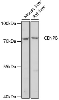 CENPB Rabbit Polyclonal Antibody
