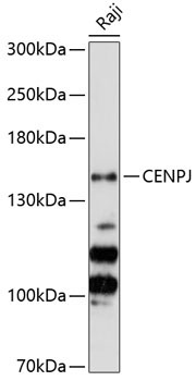 CENPJ Rabbit Polyclonal Antibody