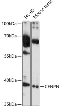 CENPN Rabbit Polyclonal Antibody