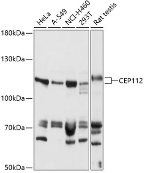 CEP112 Rabbit Polyclonal Antibody