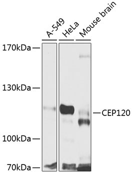 CEP120 Rabbit Polyclonal Antibody
