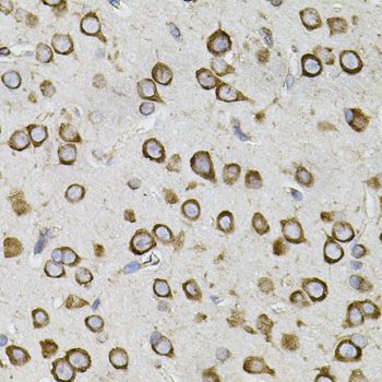 CEP164 Rabbit Polyclonal Antibody - Image 2