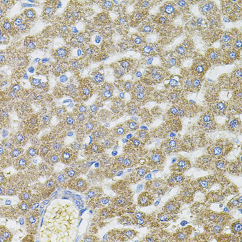 CEP164 Rabbit Polyclonal Antibody - Image 3