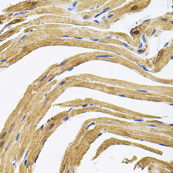 CEP164 Rabbit Polyclonal Antibody - Image 4
