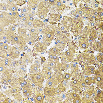 CEP164 Rabbit Polyclonal Antibody - Image 5