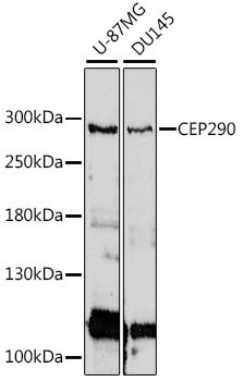 CEP290 Rabbit Polyclonal Antibody