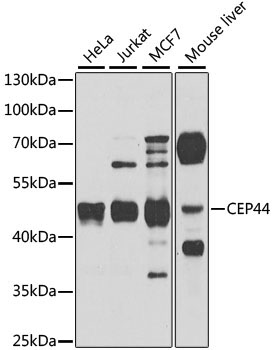 CEP44 Rabbit Polyclonal Antibody