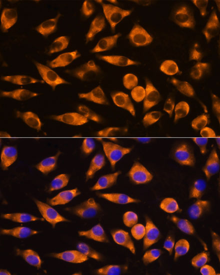 CEP55 Rabbit Polyclonal Antibody - Image 2