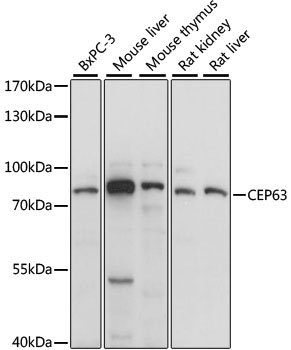 CEP63 Rabbit Polyclonal Antibody
