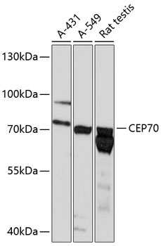 CEP70 Rabbit Polyclonal Antibody