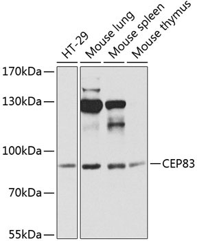 CEP83 Rabbit Polyclonal Antibody