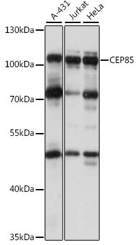 CEP85 Rabbit Polyclonal Antibody