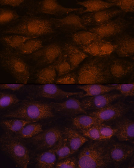 CEP85 Rabbit Polyclonal Antibody - Image 2