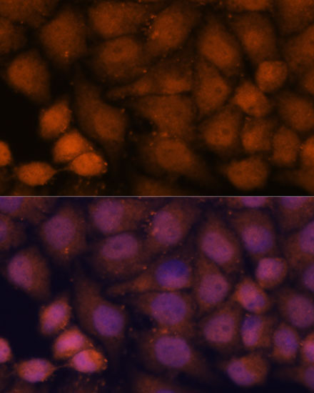 CEP85 Rabbit Polyclonal Antibody - Image 3