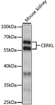 CERKL Rabbit Polyclonal Antibody