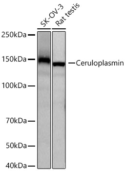 Ceruloplasmin Rabbit Monoclonal Antibody
