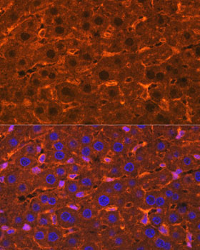 Ceruloplasmin Rabbit Polyclonal Antibody - Image 2