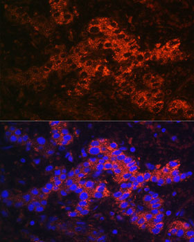 Ceruloplasmin Rabbit Polyclonal Antibody - Image 3
