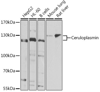 Ceruloplasmin Rabbit Polyclonal Antibody