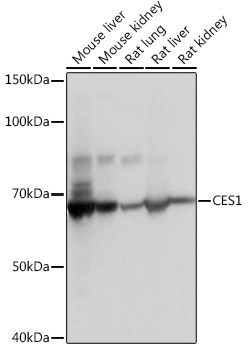 CES1 Rabbit Monoclonal Antibody