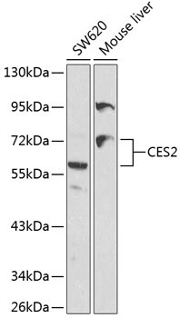 CES2 Rabbit Polyclonal Antibody