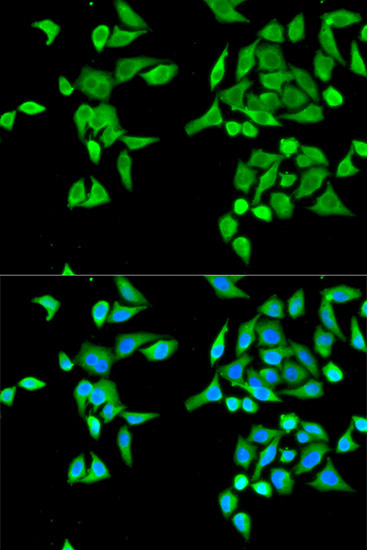 CES2 Rabbit Polyclonal Antibody - Image 2