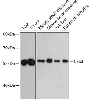 CES3 Rabbit Polyclonal Antibody