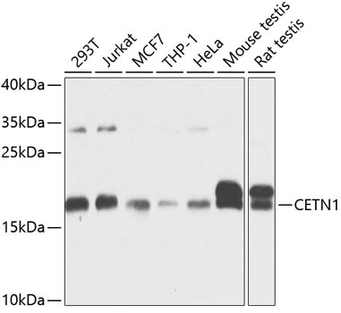 CETN1 Rabbit Polyclonal Antibody
