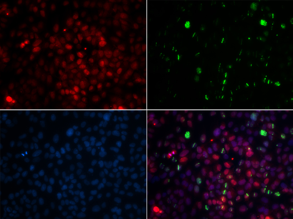CETN2 Rabbit Polyclonal Antibody - Image 3