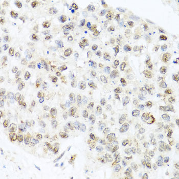 CETN3 Rabbit Polyclonal Antibody - Image 2